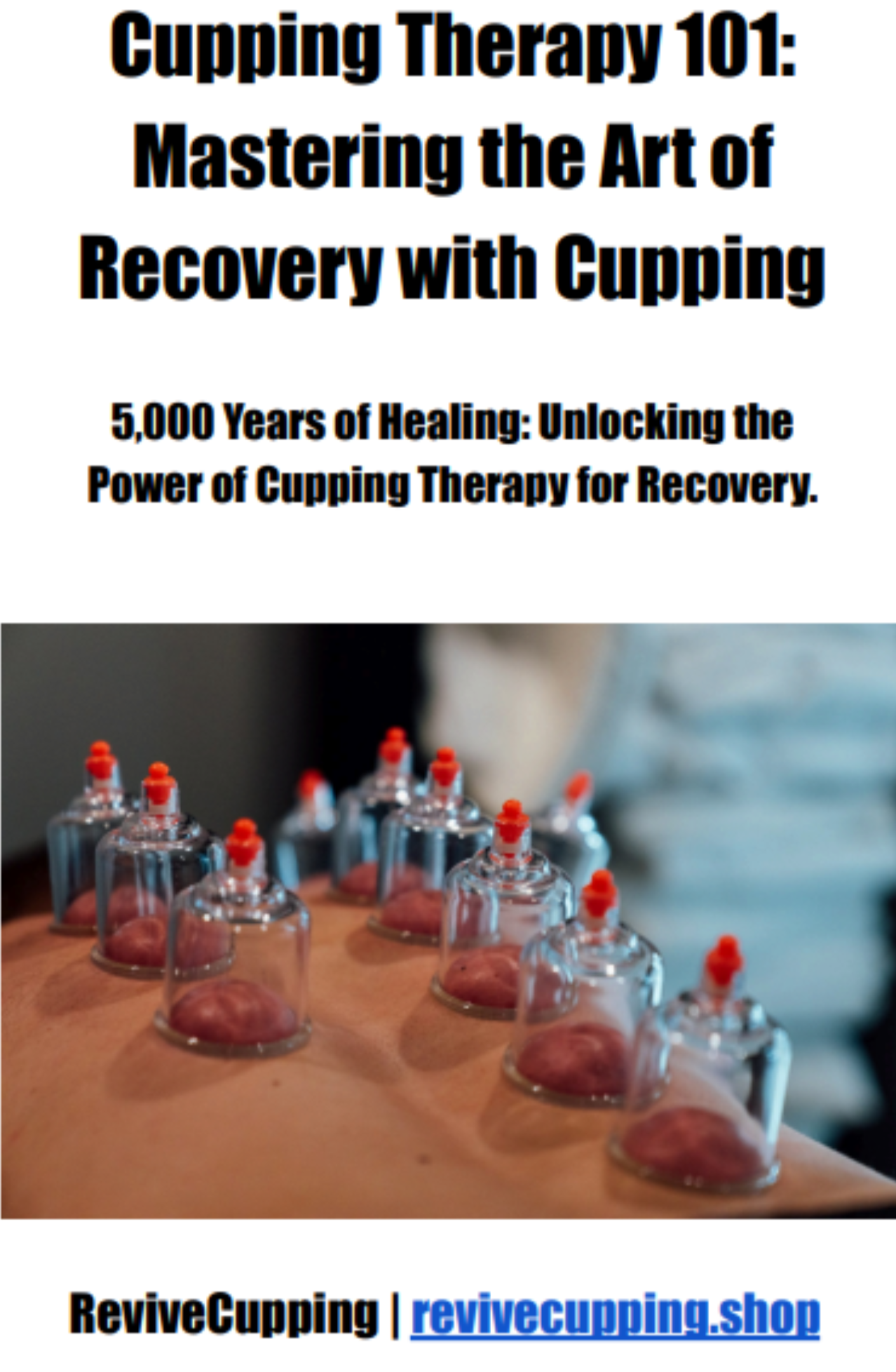 Cupping Therapy Guide: Everything You Need to Know